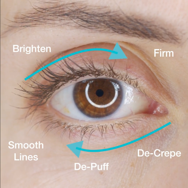 MD Complete Total Eye Treatment from MyExceptionalSkinCare.com Eye Results