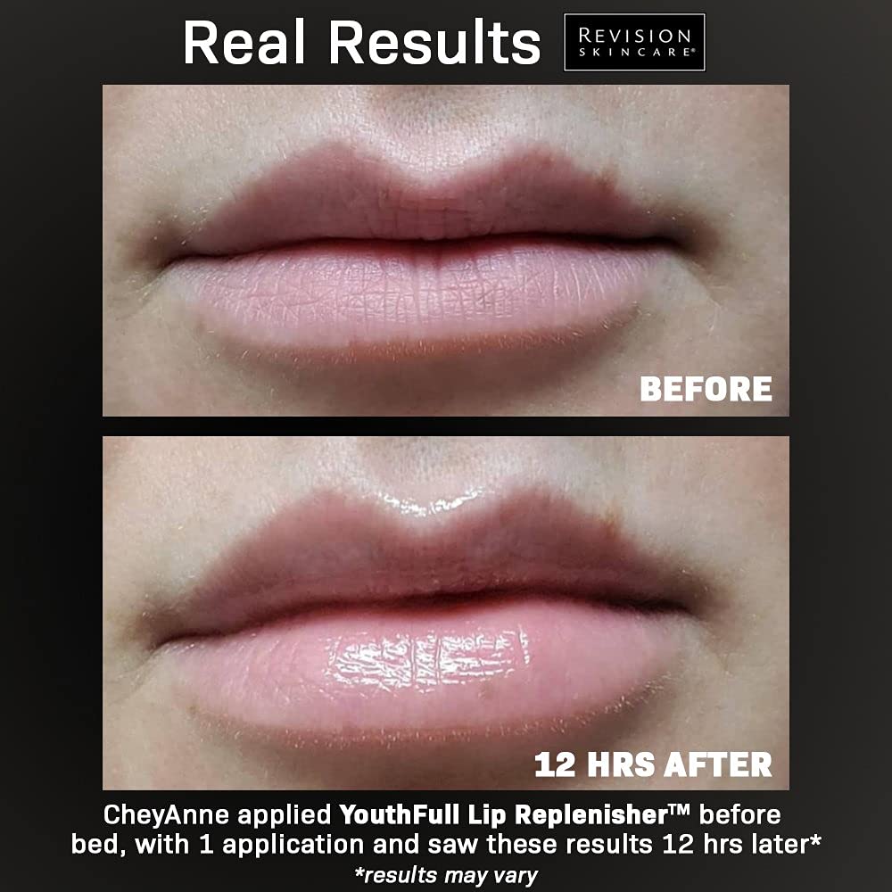 Revision Skincare Youthful Lip Replenisher from MyExceptionalSkinCare.com On Client