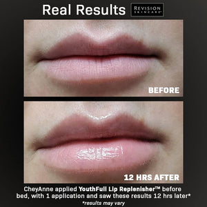 Revision Skincare Youthful Lip Replenisher from MyExceptionalSkinCare.com On Client