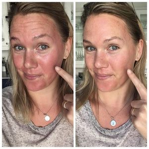 SkinCeuticals Phyto Corrective Gel from MyExceptionalSkinCare.com Before And After